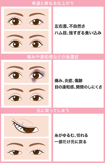 二重の失敗画像