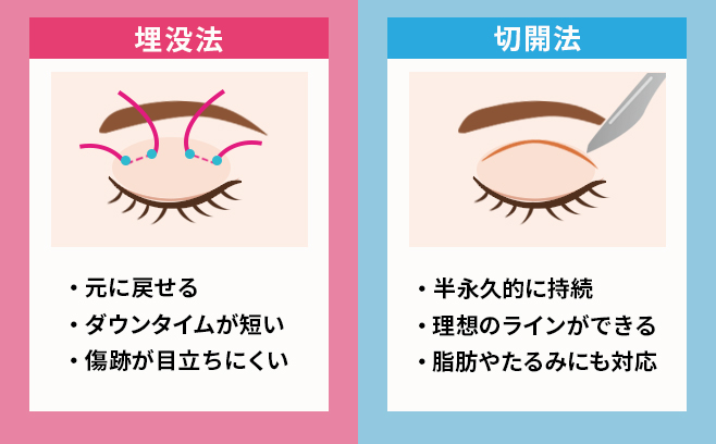 埋没法・切開法による二重のメリット