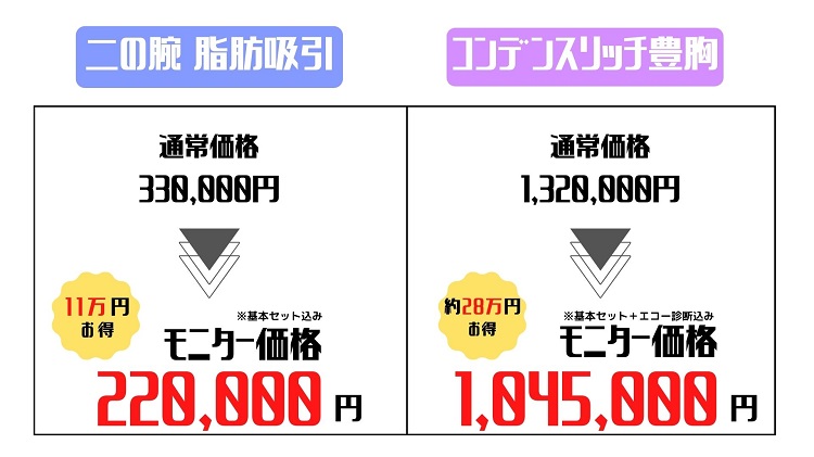 モッズクリニック 割引情報